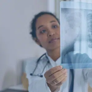 Importance of Second Opinions in Lung Cancer Care