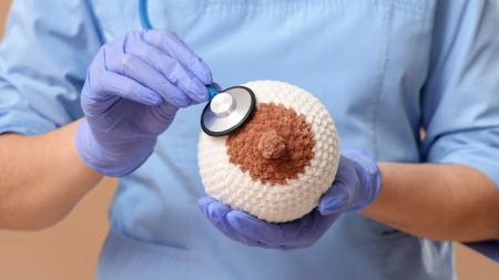 A Family Guide to Breast Cancer Symptoms and Treatments
